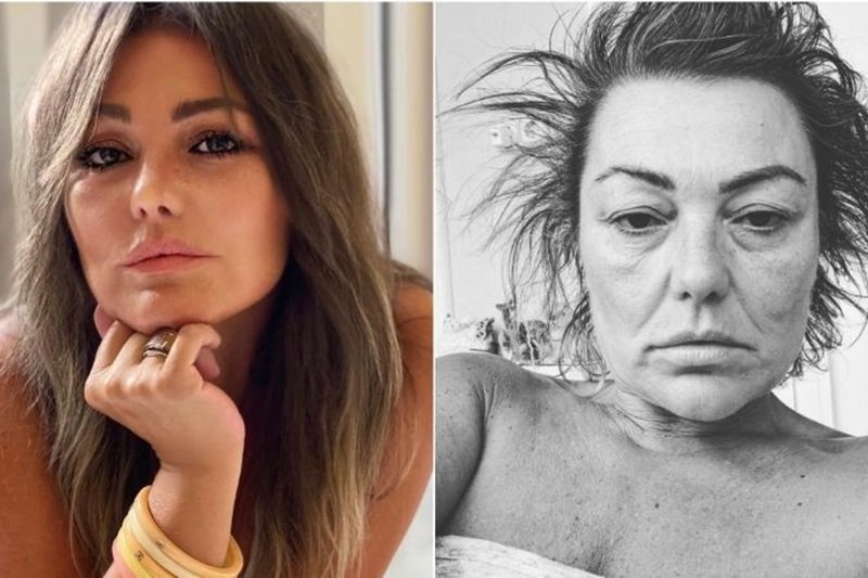 La cantante española Amaia Montero ha hablado abiertamente sobre su lucha contra el trastorno ansioso depresivo